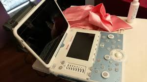 ECOGRAFO MAMMARIO: un passo verso la Prevenzione. Image